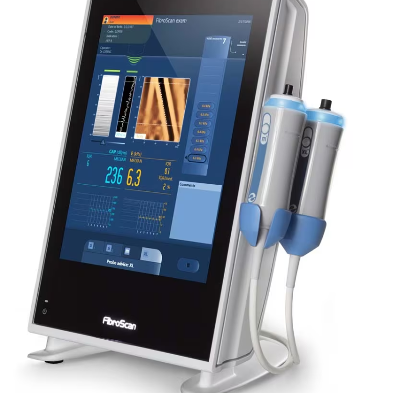 Elastometria Epatica (Fibroscan)