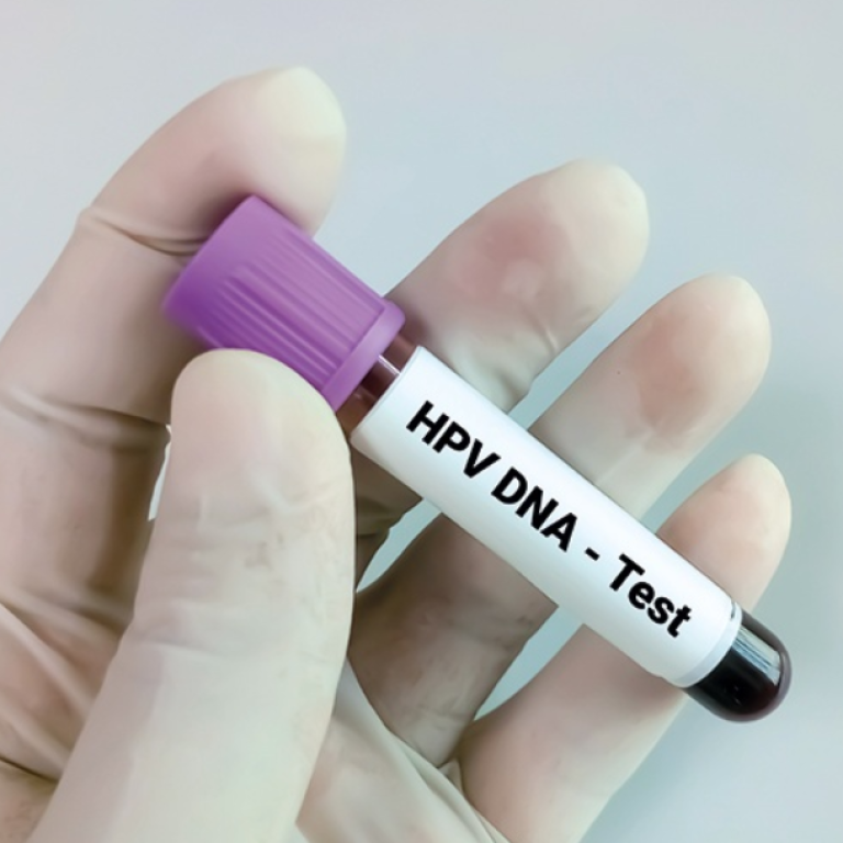 HPV-DNA Test