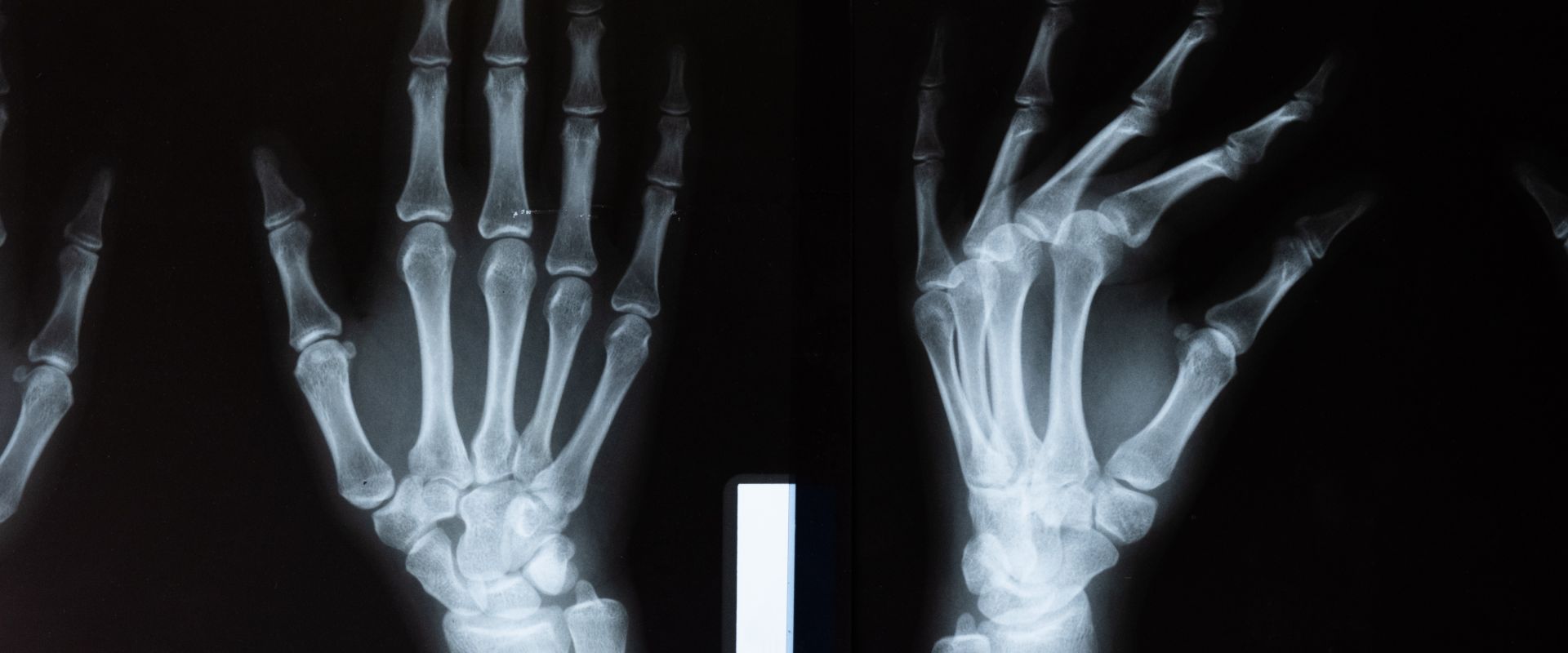 Radiologia