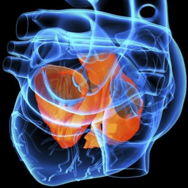 Ecografia Cardiaca ed Ecocardiocolordoppler