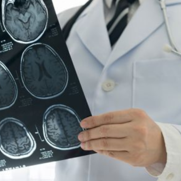 Visita Neurologica