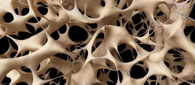 Check-Up Prevenzione Osteoporosi