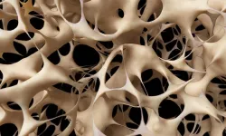 Check-Up Prevenzione Osteoporosi