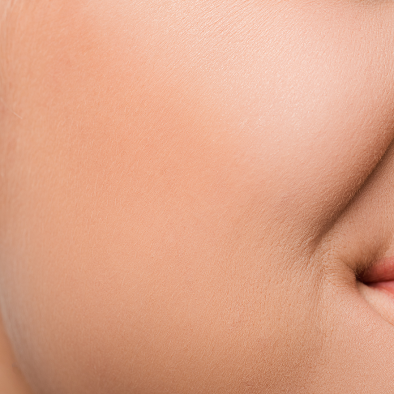 Biostimolazione