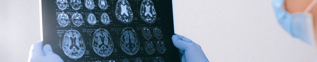 Neurologia